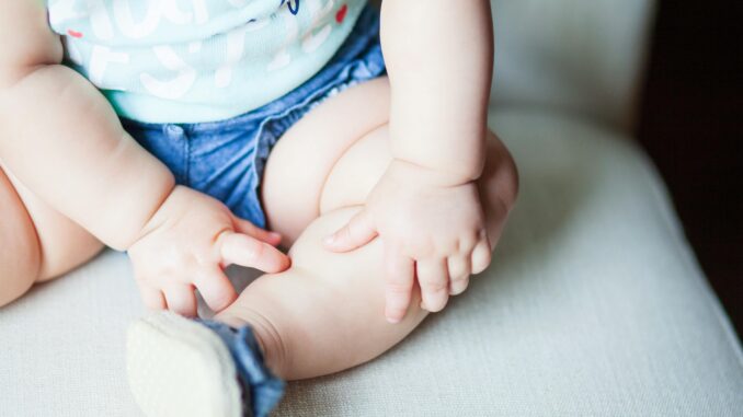 La pelle secca nei bambini: quali sono le cause?